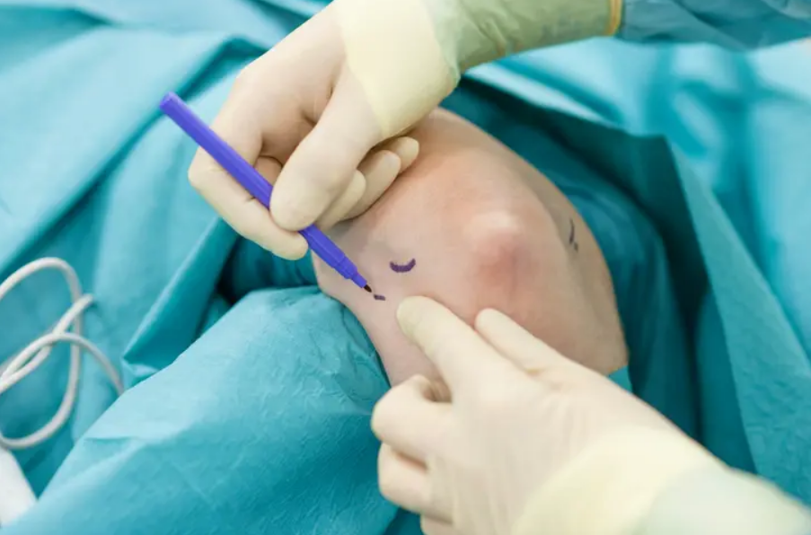 Elbow Arthroscopy Knee Arthroscopy: Procedure, Benefits & Recovery