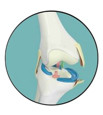 Medial Collateral Ligament (MCL)