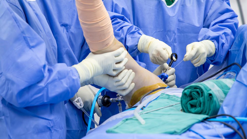 Arthroscopy Surgery