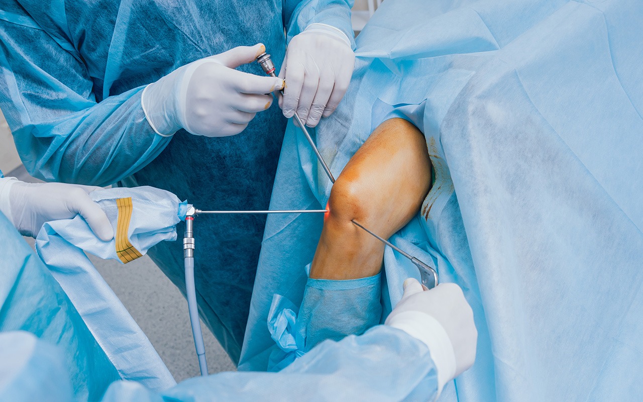 Knee Arthroscopy Surgery