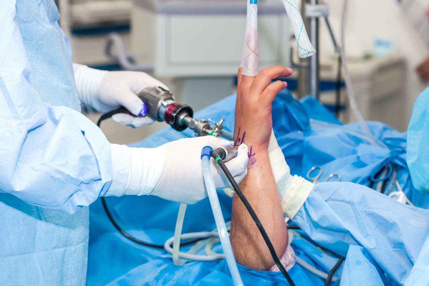Hand & Wrist Arthroscopy